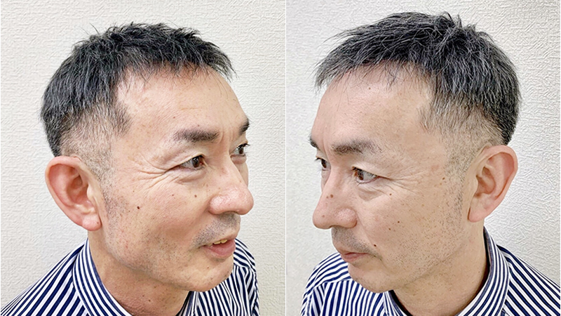 ショートヘアーのカツラ着用写真