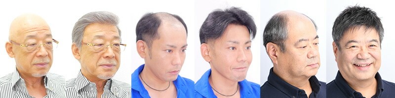 オーダーメイドかつらのビフォーアフター