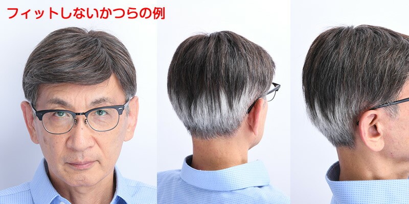 フォットしないカツラの例