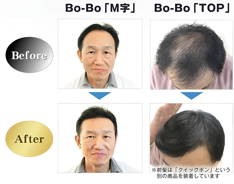 Before After