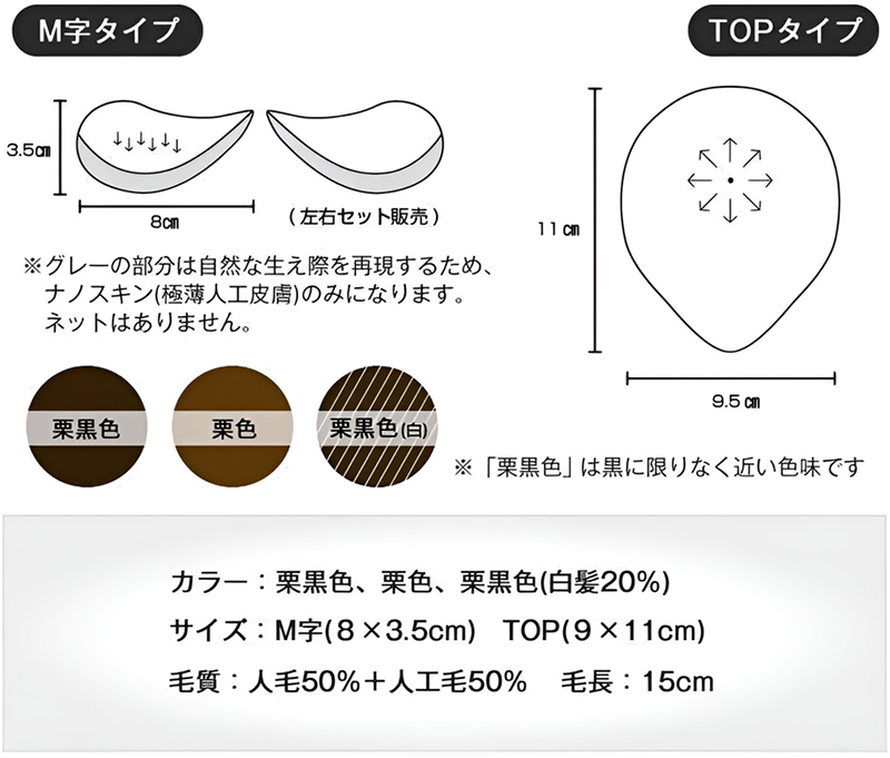 インタビュー1